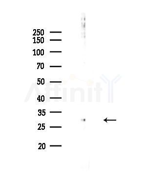 RNF144A Antibody - Western blot analysis of lysates from HepG2 cells(UV,30min treatment), using RNF144A Antibody at 1/1000 dilution.