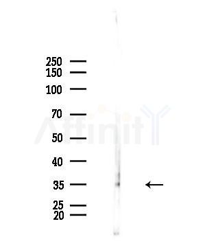UBR1 Antibody - Western blot analysis of lysates from EC304 cells, using UBR1 Antibody at 1/1000 dilution.