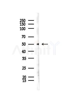 EFEMP2 Antibody - Western blot analysis of lysates from B16F10-LUC cells(starvation,24h treatment), using EFEMP2 Antibody at 1/1000 dilution.