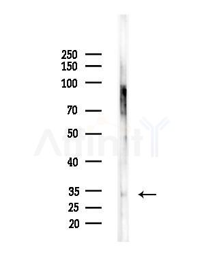 ELOVL1 Antibody - Western blot analysis of lysates from RAW264.