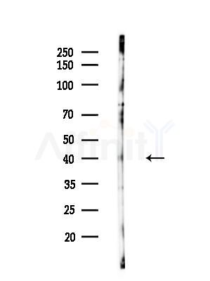 ELOVL4 Antibody - Western blot analysis of lysates from HUVEC cellsLPS, using ELOVL4 Antibody at 1/1000 dilution.