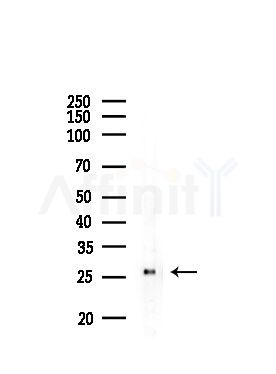 ELOVL5 Antibody - Western blot analysis of lysates from Rat liver, using ELOVL5 Antibody at 1/1000 dilution.