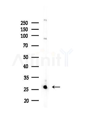 ELOVL5 Antibody - Western blot analysis of lysates from HepG2 cells(LPS,4h treatment), using ELOVL5 Antibody at 1/1000 dilution.
