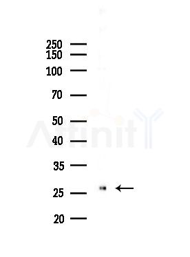 ELOVL5 Antibody - Western blot analysis of lysates from PC12 cells(LPS,4h treatment), using ELOVL5 Antibody at 1/1000 dilution.