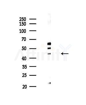 NEIL1 Antibody - Western blot analysis of lysates from HepG2 cells(UV,30min treatment), using NEIL1 Antibody at 1/1000 dilution.