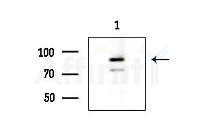 EPHA10 Antibody - Western blot analysis of extracts from HepG2 cells(UV 30min treatment), using EPHA10 Antibody at 1/1000 dilution.