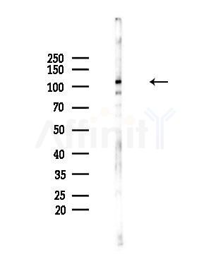 EPHA10 Antibody - Western blot analysis of lysates from HepG2 cells(UV,30min treatment), using EPHA10 Antibody at 1/1000 dilution.