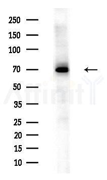 EPN2 Antibody - Western blot analysis of lysates from Hela cells, using EPN2 Antibody at 1/1000 dilution.
