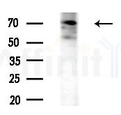 EPN2 Antibody - Western blot analysis of lysates from Mouse liver, using EPN2 Antibody at 1/1000 dilution.