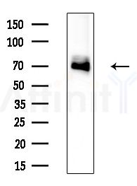EPN2 Antibody - Western blot analysis of lysates from HepG2 cells(LPS 4h treatment), using EPN2 Antibody at 1/1000 dilution.