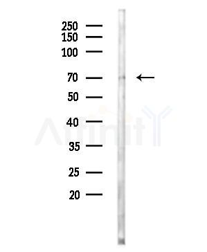 EPN3 Antibody - Western blot analysis of lysates from MDA-MB-231 cells, using EPN3 Antibody at 1/1000 dilution.