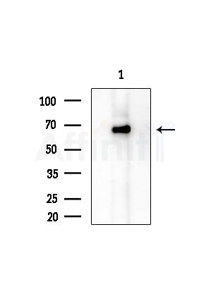 EIF2AK1 Antibody - Western blot analysis of extracts from COLO205 cells, using EIF2AK1 Antibody at 1/1000 dilution.