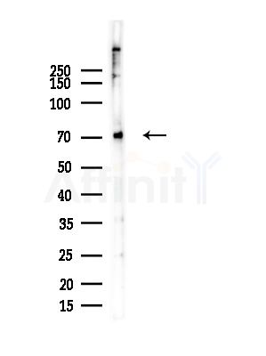 EIF2AK1 Antibody - Western blot analysis of lysates from COLO205 cells, using EIF2AK1 Antibody at 1/1000 dilution.