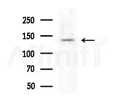 EIF5B Antibody - Western blot analysis of extracts from HepG2 cells
(heat-shock treatment), using EIF5B Antibody at 1/1000 dilution.