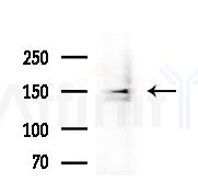 EIF5B Antibody - Western blot analysis of extracts from B16F10-LUC cells
(heat-shock treatment), using EIF5B Antibody at 1/1000 dilution.