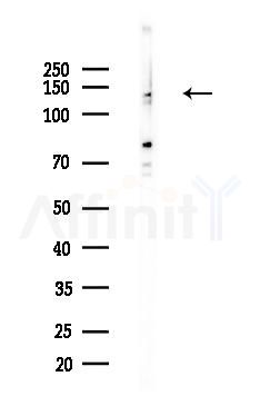 EIF5B Antibody - Western blot analysis of lysates from B16F10-LUC cells(heat-shock,45min treatment), using EIF5B Antibody at 1/1000 dilution.