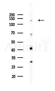 EIF5B Antibody - Western blot analysis of lysates from HepG2 cells(heat-shock,45min treatment), using EIF5B Antibody at 1/1000 dilution.