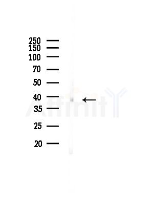 FKBPL Antibody - Western blot analysis of lysates from EC304 cells(starvation,24h treatment), using FKBPL Antibody at 1/1000 dilution.