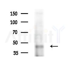 FOXD4 Antibody - Western blot analysis of extracts from HepG2 cells(starvation,24h treatment), using FOXD4 Antibody at 1/1000 dilution.