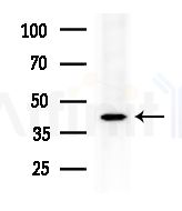 FOXN4 Antibody - Western blot analysis of extracts from HepG2 cells
(heat-shock treatment), using FOXN4 Antibody at 1/1000 dilution.