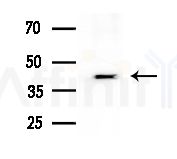 FOXN4 Antibody - Western blot analysis of extracts from B16F10-LUC cells
(heat-shock treatment), using FOXN4 Antibody at 1/1000 dilution.