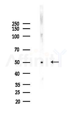 FOXN4 Antibody - Western blot analysis of lysates from B16F10-LUC cells(heat-shock,45min treatment), using FOXN4 Antibody at 1/1000 dilution.