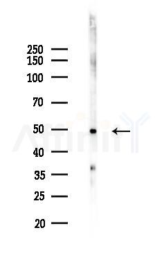FOXN4 Antibody - Western blot analysis of lysates from HepG2 cells(heat-shock,45min treatment), using FOXN4 Antibody at 1/1000 dilution.