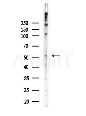 GABRG1 Antibody - Western blot analysis of lysates from HepG2 cells(LPS,4h treatment), using GABRG1 Antibody at 1/1000 dilution.