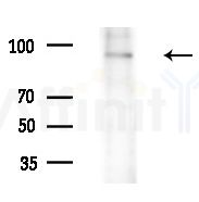 IFI16 Antibody - Western blot analysis of extracts from Hela cells, using IFI16 Antibody at 1/1000 dilution.