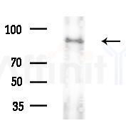 IFI16 Antibody - Western blot analysis of extracts from HepG2 cells(LPS 4h treatment), using IFI16 Antibody at 1/1000 dilution.
