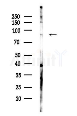 IFI16 Antibody - Western blot analysis of lysates from HepG2 cells(LPS 4h treatment), using IFI16 Antibody at 1/1000 dilution.