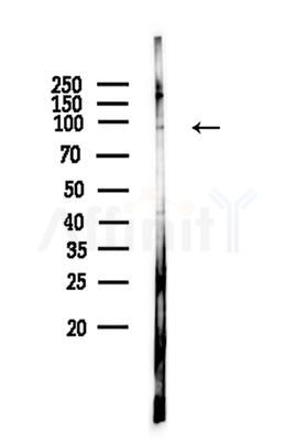 IFI16 Antibody - Western blot analysis of lysates from Hela cells, using IFI16 Antibody at 1/1000 dilution.