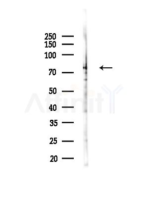 TUBGCP4 Antibody - Western blot analysis of lysates from Hela cells, using TUBGCP4 Antibody at 1/1000 dilution.