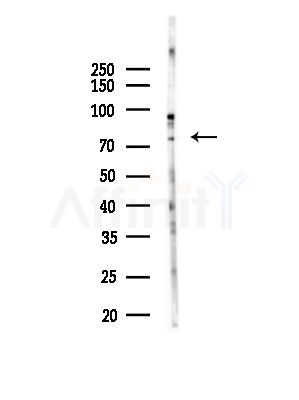 TUBGCP4 Antibody - Western blot analysis of lysates from COLO205 cells, using TUBGCP4 Antibody at 1/1000 dilution.