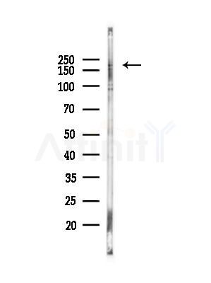TUBGCP6 Antibody - Western blot analysis of lysates from B16F10-LUC cells(heat-shock,45min treatment), using TUBGCP6 Antibody at 1/1000 dilution.
