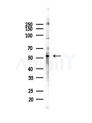 TSTA3 Antibody - Western blot analysis of lysates from COLO205 cells(heat-shock,45min treatment), using TSTA3 Antibody at 1/1000 dilution.