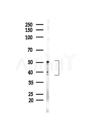 TSTA3 Antibody - Western blot analysis of lysates from MDA-MB-231 cells(heat-shock,45min treatment), using TSTA3 Antibody at 1/1000 dilution.