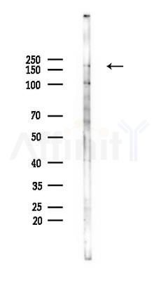 GRIN2D Antibody - Western blot analysis of lysates from EC304 cells, using GRIN2D Antibody at 1/1000 dilution.