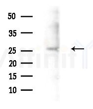 GSTT1 Antibody - Western blot analysis of extracts from Mouse liver, using GSTT1 Antibody at 1/1000 dilution.