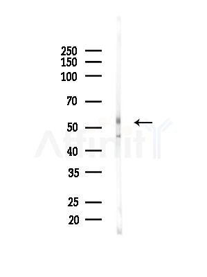 GLRB Antibody - Western blot analysis of lysates from Mouse brain, using GLRB Antibody at 1/1000 dilution.