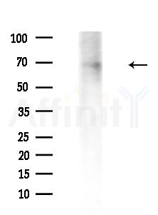 GRB14 Antibody - Western blot analysis of extracts from Mouse liver, using GRB14 Antibody at 1/1000 dilution.