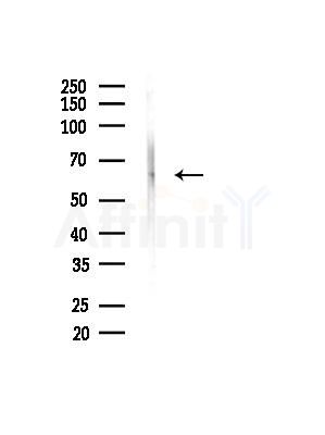 GRB14 Antibody - Western blot analysis of lysates from Mouse liver, using GRB14 Antibody at 1/1000 dilution.