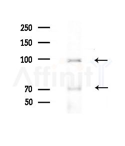 GIDRP88 Antibody - Western blot analysis of extracts from Rat brain, using GIDRP88 Antibody at 1/1000 dilution.