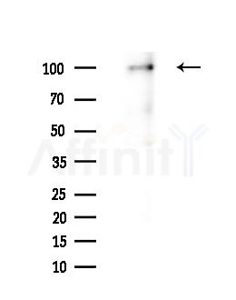 GIDRP88 Antibody - Western blot analysis of extracts from A375 cells(heat-shock,45min treatment), using GIDRP88 Antibody at 1/1000 dilution.