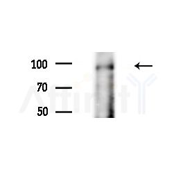 GIDRP88 Antibody - Western blot analysis of extracts from Mouse liver, using GIDRP88 Antibody at 1/1000 dilution.