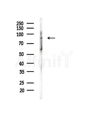 GIDRP88 Antibody - Western blot analysis of lysates from Mouse liver, using GIDRP88 Antibody at 1/1000 dilution.