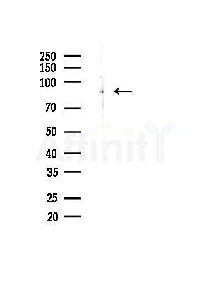 GIDRP88 Antibody - Western blot analysis of lysates from A375 cells(heat-shock,45min treatment), using GIDRP88 Antibody at 1/1000 dilution.