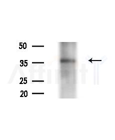 GAS1 Antibody - Western blot analysis of lysates from COLO205 cells(heat-shock,45min treatment), using GAS1 Antibody at 1/1000 dilution.