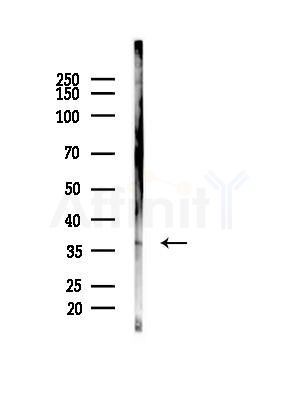 GAS1 Antibody - Western blot analysis of lysates from COLO205 cells(heat-shock,45min treatment), using GAS1 Antibody at 1/1000 dilution.
