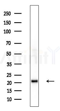 DIRA1 Antibody - Western blot analysis of extracts from Hela cells, using DIRA1 Antibody at 1/1000 dilution.